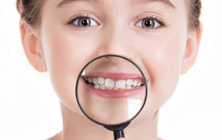 مراقبت از دندانهای شیری