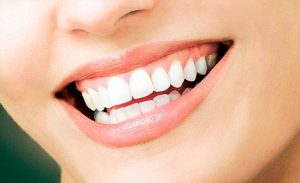 کلینیک دندانپزشکی دکتر سید رضا ناصری,لیرینگ دندان