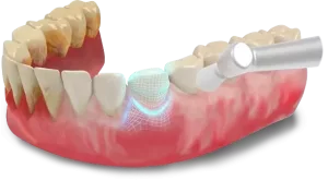 کلینیک دندانپزشکی دکتر سید رضا ناصری,لیرینگ دندان,ایمپلنت دندان,کامپوزیت ونیر دندان,لمینت دندان,جرمگیری دندان,,ترمیم دندان,