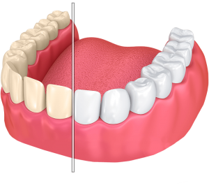 کلینیک دندانپزشکی دکتر سید رضا ناصری,لیرینگ دندان,ایمپلنت دندان,کامپوزیت ونیر دندان,لمینت دندان, بلیچینگ دندان
